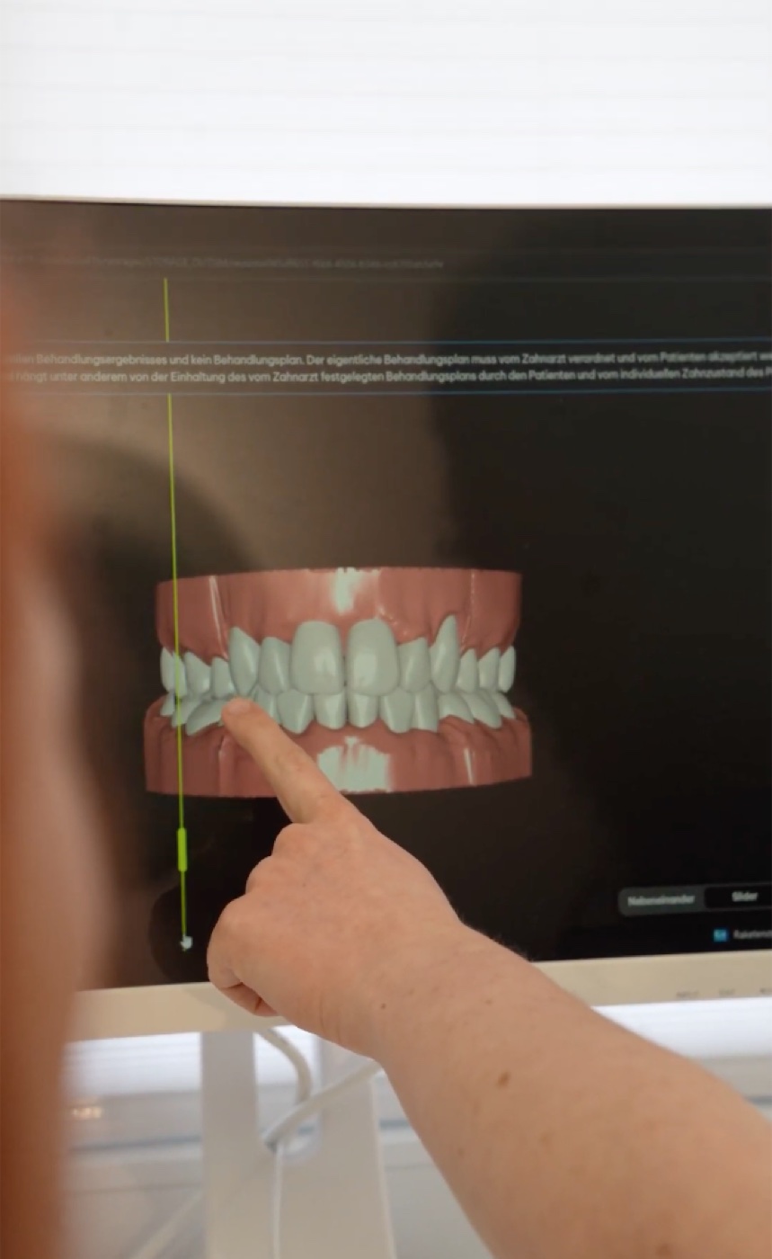 3D-Scan und digitale Vorschau am Monitor